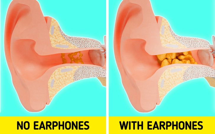 Prolonged use of earphones in the ears can be fatal, posing a significant risk of illness